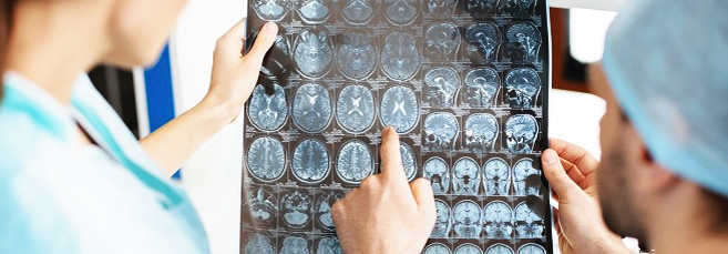 Суперкроппинг каннабиса Как выполнить суперкроппинг марихуаны